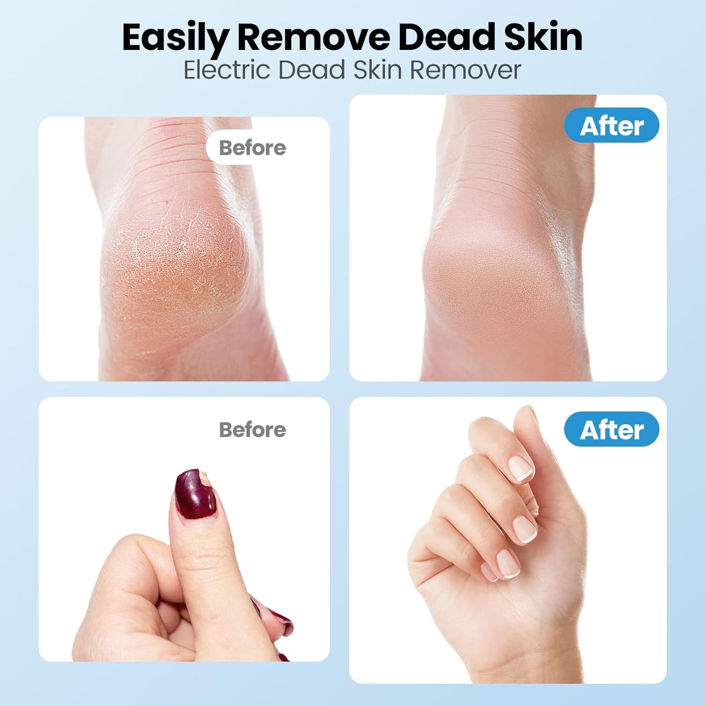 Electric Callus Remover for Feet, 2 in 1 Electric Foot File Grinder, Rechargeable Cordless Foot Scrubber for Dead Skin, Adjustable Speed with Sandpaper Discs, Professional Pedicure Tools,Black