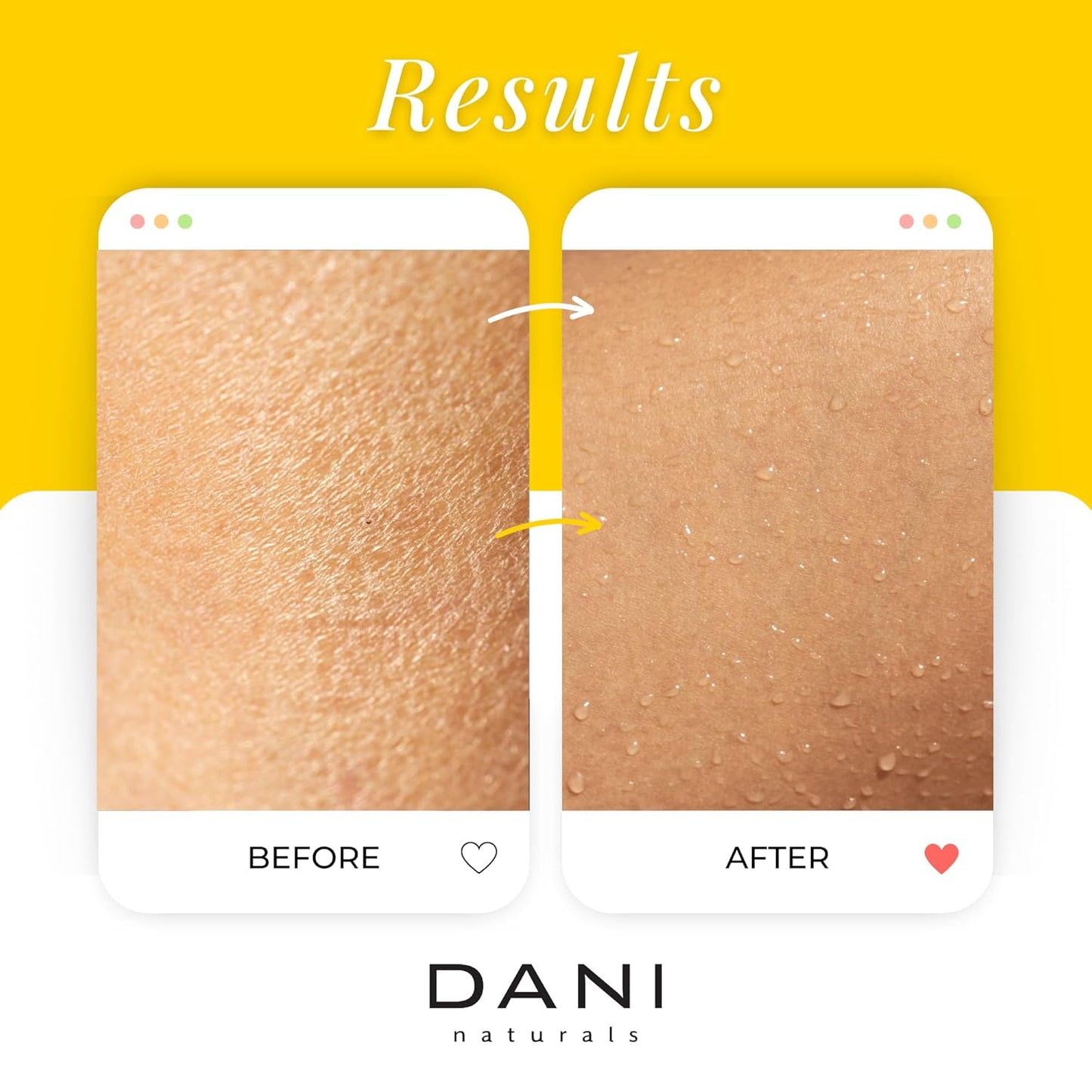 Naturals Exfoliating Sugar Scrub - Warm Sandalwood Vanilla, featuring organic cane sugar and shea butter, gently exfoliates and deeply nourishes for smooth, radiant, and hydrated skin – 14 oz