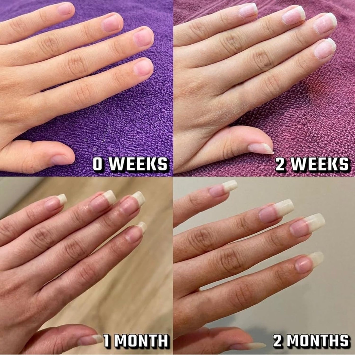 Shana Paris Nail ππ«π¨π°ππ‘ Oil, Radiant Nail ππ«π¨π°ππ‘ Oil Pen for Moisturize Strengthen Nails Care, Cuticle Oil for Nails Finger Edge Manicure Nourishing (3pcs, 2ml)