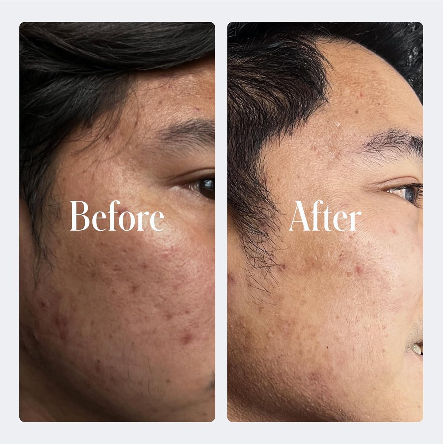 Geologie Retinol Anti-Aging Face Cream | Advanced .3% Retinol Formula for Effective Results | Reduce Fine Lines & Wrinkles | Protect & Repair Skin With Hyaluronic Acid & Niacinamide | For Men & Women