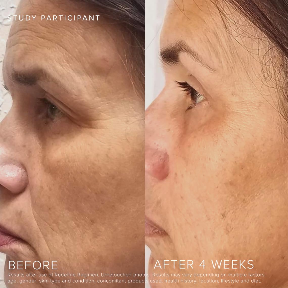 RODAN + FIELDS Redefine Daily Foaming Cleanser | 125 mL | Gently Exfoliating Skin Care | Face Wash & Makeup Remover | Deep Cleansing with Anti Aging Properties