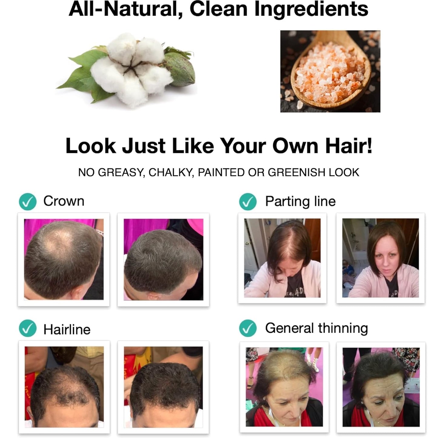 Caboki Hair Loss Concealer. All-Natural Hair Building Fiber. Make Thin Hair Look 10X Fuller Instantly. Eliminate the Appearance of Bald Spot and Thinning Hair (30G, 90-Day Supply). Salt & Pepper-Dark