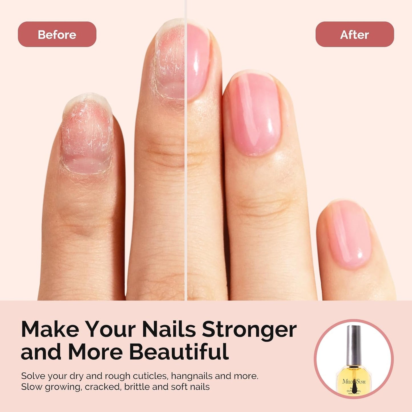 MelodySusie No Wipe Glossy Top Coat Base Coat Cuticle Oil Set Long Lasting Shine Finish Soak Off UV LED Nail Lamp Nail Art Design Manicure Kit Perfect Gifts for Women Girls 3 Pcs 15ml