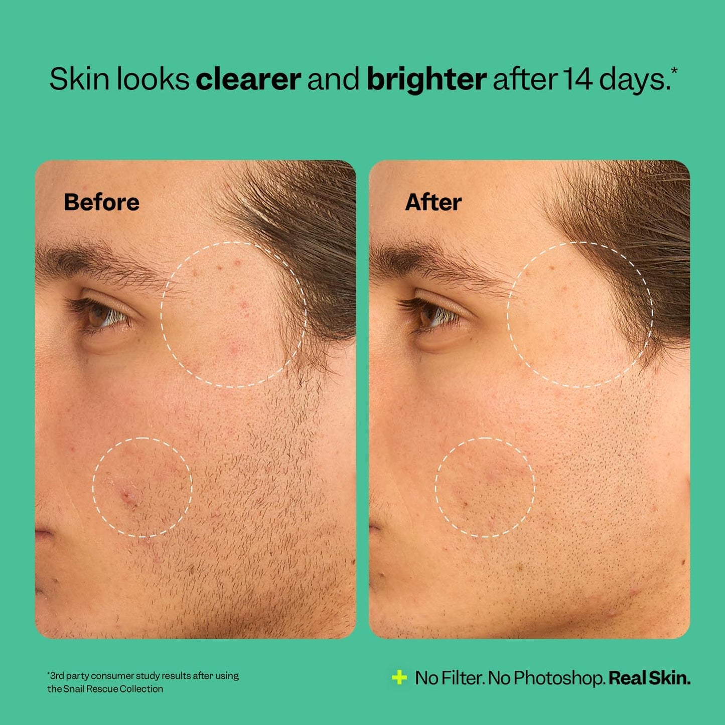 Peach Slices | Snail Rescue Blemish Busting Toner | 95% Snail Mucin | Pore Cleaner | Hydrates & Balances | Korean Skin Care | CICA | Hyaluronic Acid | Non-Comedogenic | Cruelty-Free | 4.05 oz