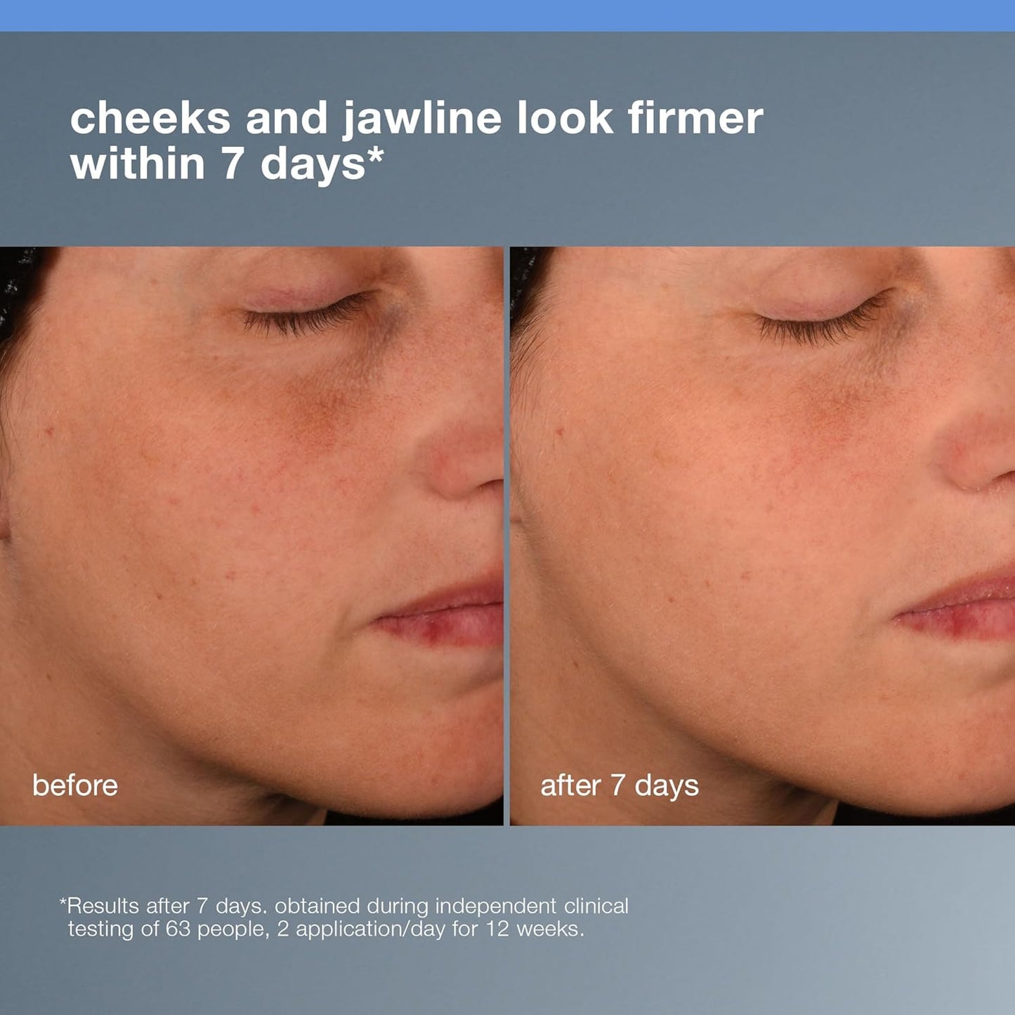 Dermalogica Pro Collagen Banking Serum for Face, Plumping and Preserving Skin's Collagen, Prevent Wrinkles and Fine Lines with Amino Acid, 1 fl oz