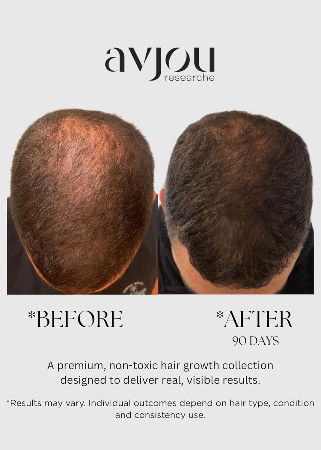 Avjou Researche™ Scalp Serum – Thicker, Fuller-Looking Hair + Targets Visible Signs of Premature Greying – 3 Patented Ingredients – Backed by Cosmetic Science – Oil-Free, All Hair Types, 1.7 oz