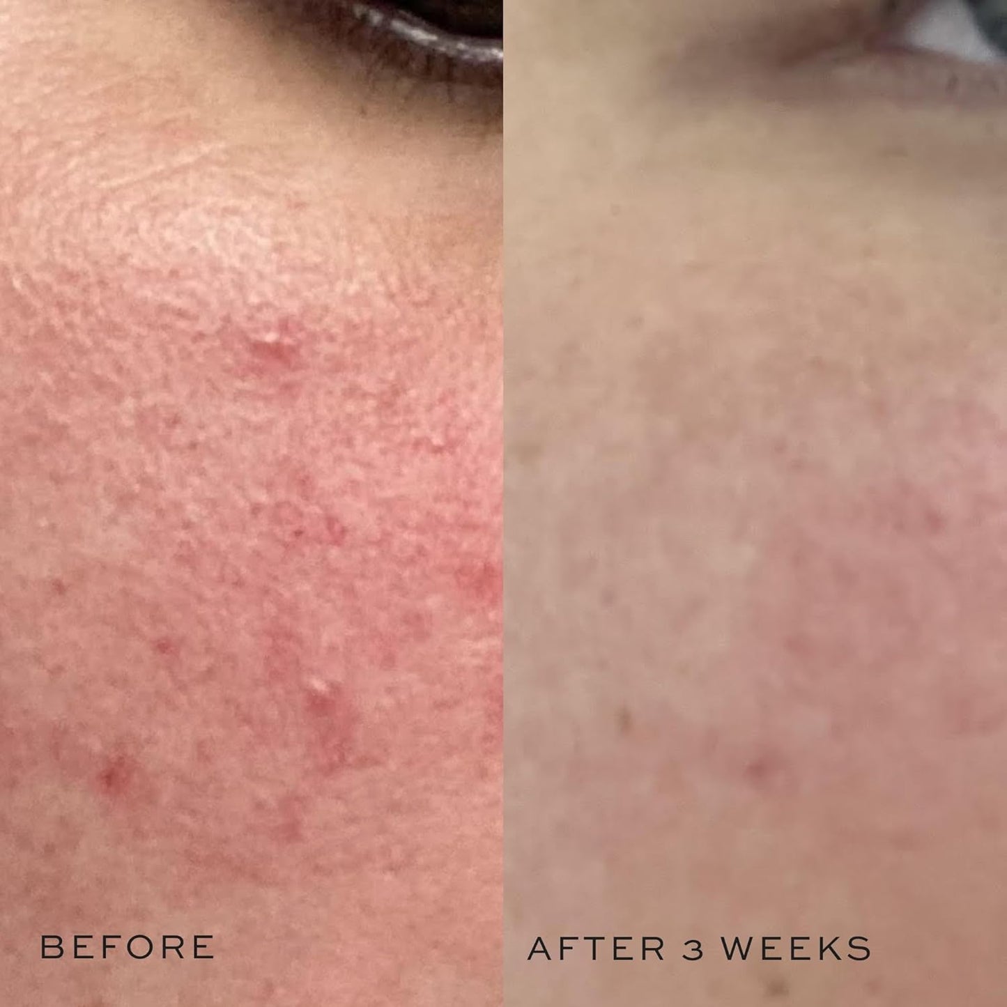 DIME Beauty Mini Super Skin Toner, Alcohol-Free Witch Hazel Toner, Travel-Size with Cucumber Extract, 2 oz / 60 ml