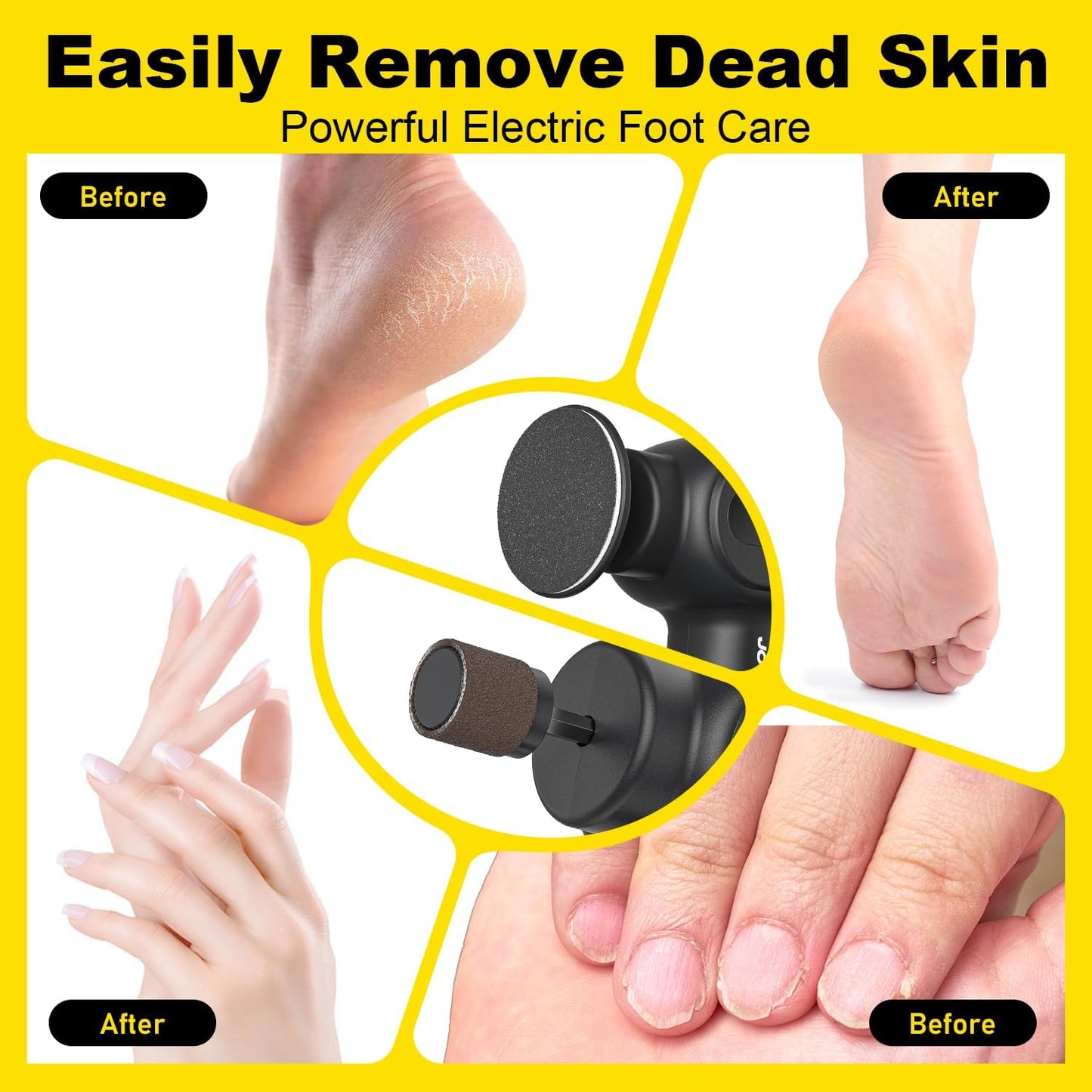 Electric Foot Callus Remover Rechargeable, Electronic Foot File Pedicure Tool, 2 in 1 Foot Grinder, Pro Foot Scrubber Kit for Dead, Hard, Cracked Skin, with 6 Speeds & 20 Sandpaper Discs