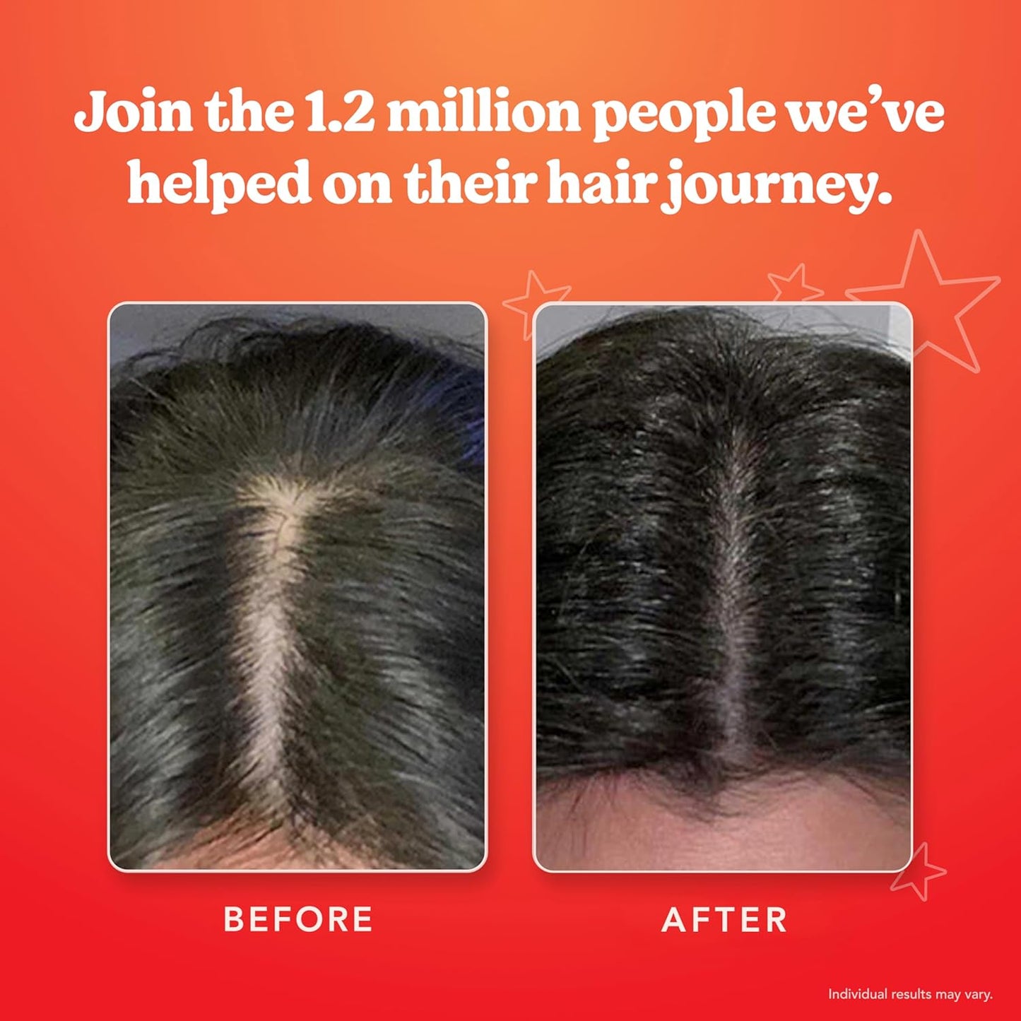 HAIRtamin Scalp Serum Natural Hair Growth Thickening | Made in USA | Helps Increase Hair Thickness and Aids Against Hair Thinning and Hair Fall Out | Moisturizes and Soothes Dry Itchy Scalp