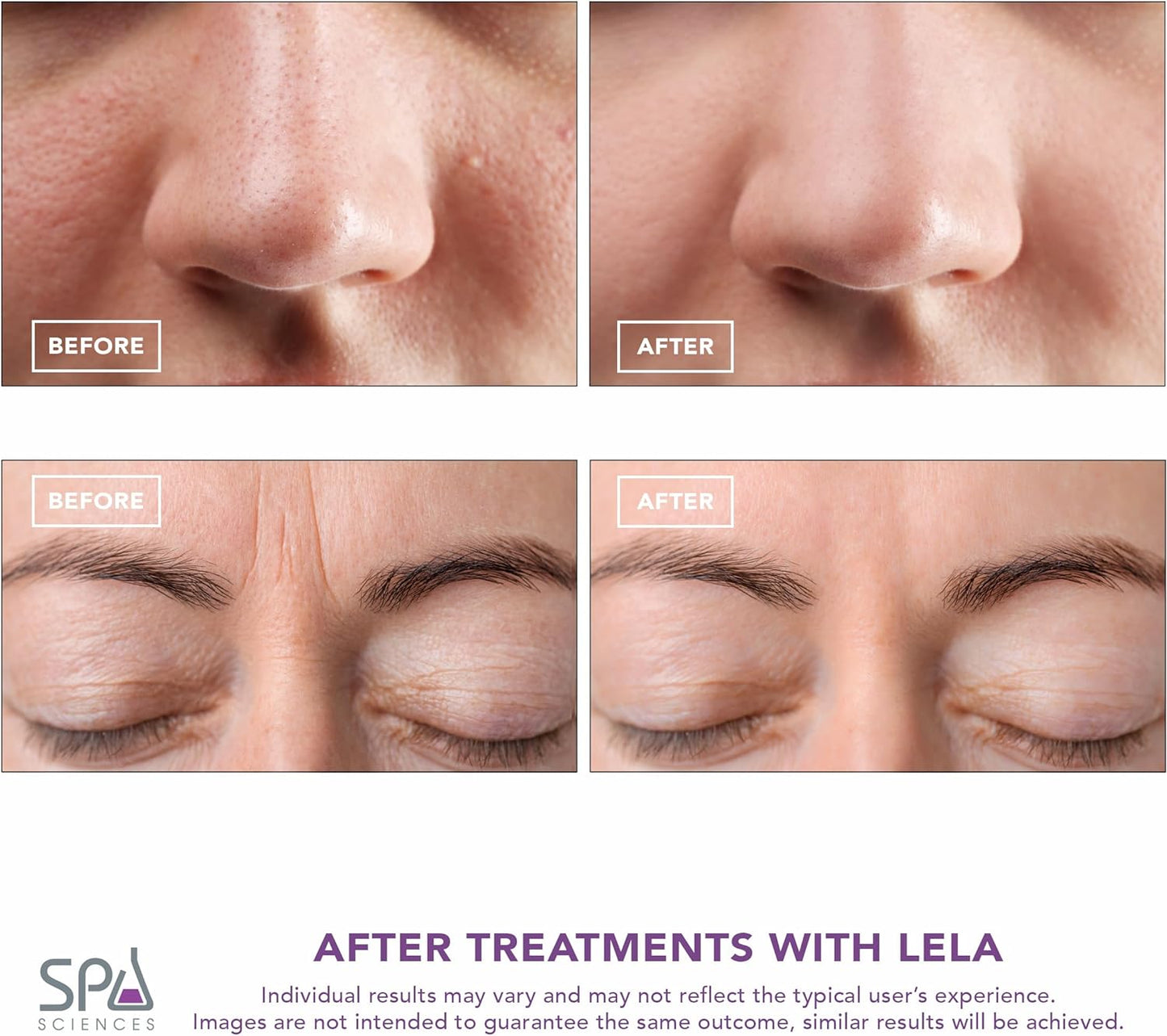 Spa Sciences - LELA - 4-in-1 Facial Spatula for Deep Cleansing, Pore Extraction, Serum Infusion, Anti-Aging and Contouring