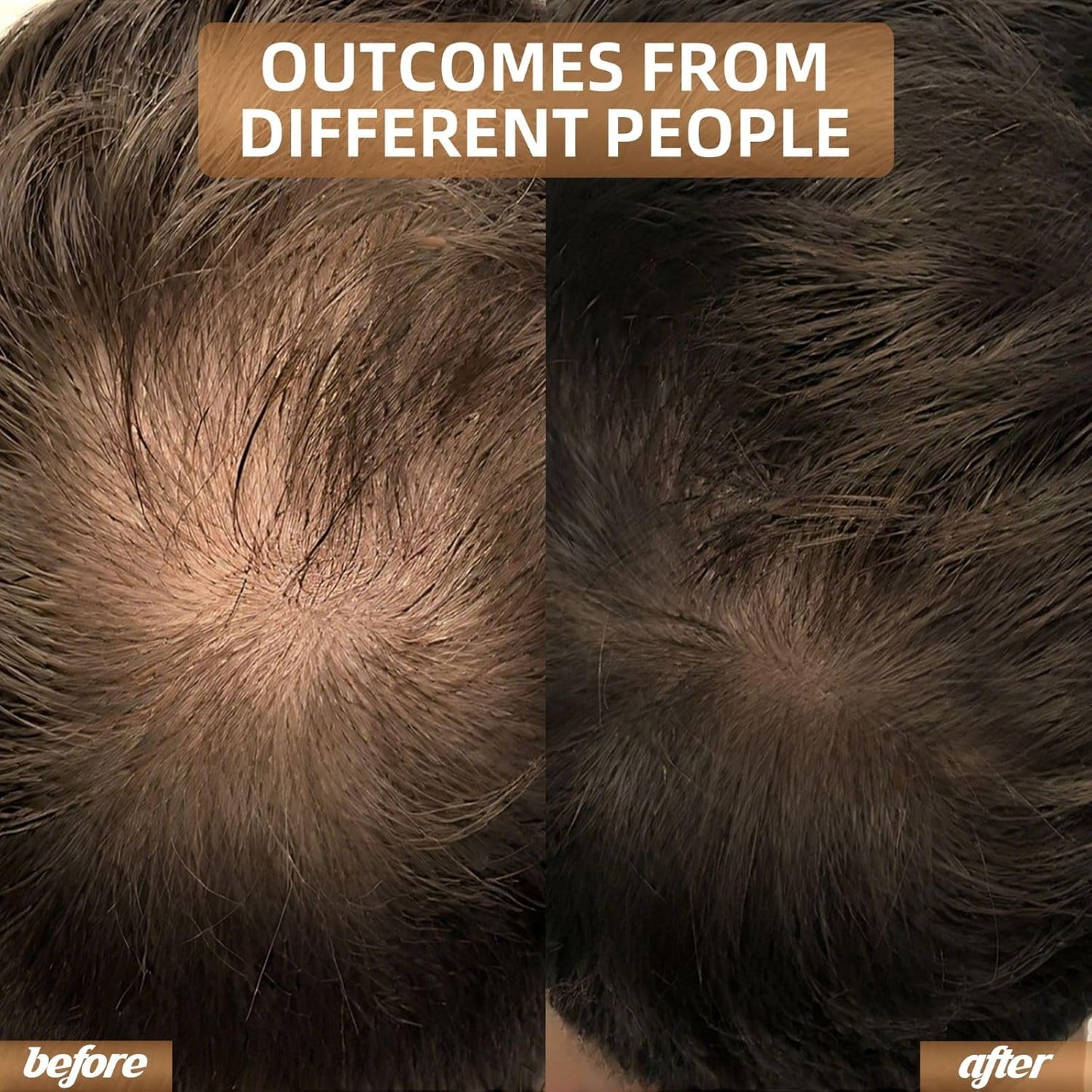 Red Light Therapy for Hair Growth, Breathable Cap Panels with Quick-Release Function