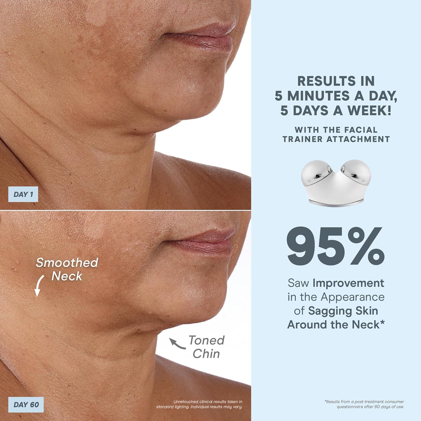 NuFACE TRINITY+ Effective Lip & Eye Attachment for Microcurrent Facial Device - FDA Cleared At Home Eye Lift & Smile Lines Treatment to Tighten & Tone Hard-to-Reach Areas Around Mouth and Eyes